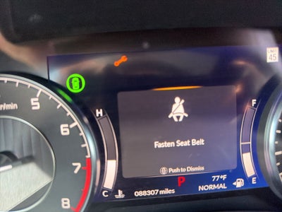 2021 Acura TLX Technology Package